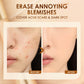 FOCALLURE Matte Concealer Cream