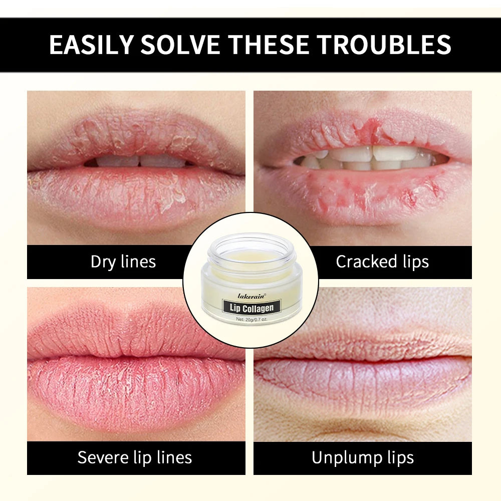 Lip Balm Collagen Lighten Melanin Lip Mask Exfoliating Fade Lip Line Dead Skin Moisturizing Brighten Repair Lip Care Products